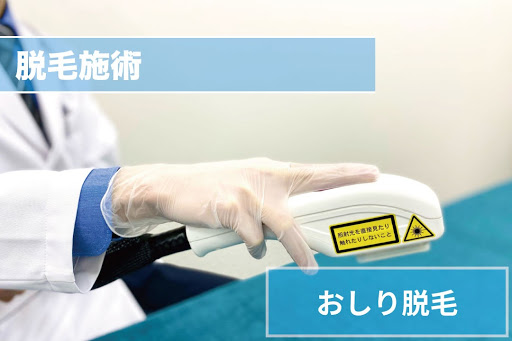 おしり脱毛Step4