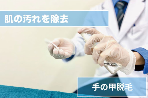 手の甲脱毛Step3