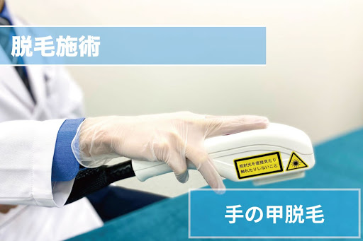 手の甲脱毛Step4