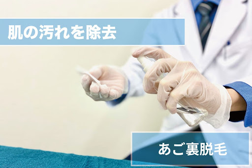 あご裏ひげ脱毛Step3