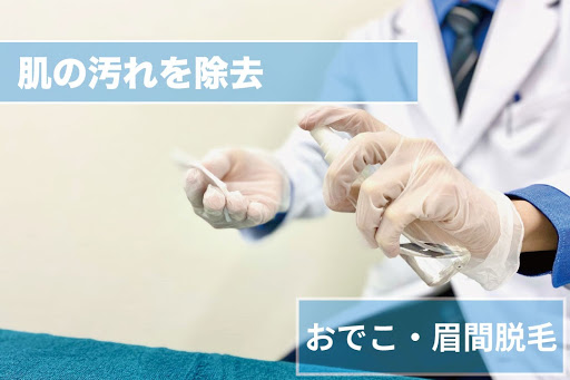 おでこ・眉間脱毛Step3