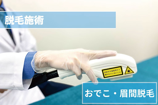 おでこ・眉間脱毛Step4