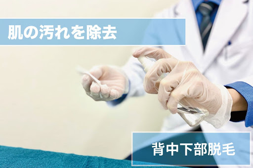 背中下脱毛Step3